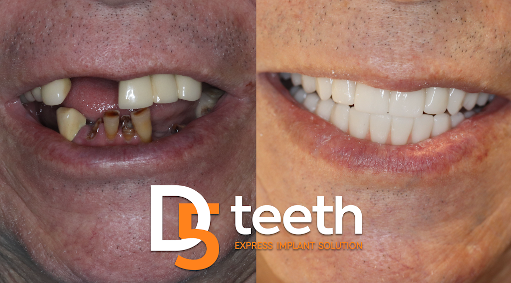 D5teeth - Philadelphia | 700 S Henderson Rd SUITE 306, King of Prussia, PA 19406 | Phone: (215) 253-5925