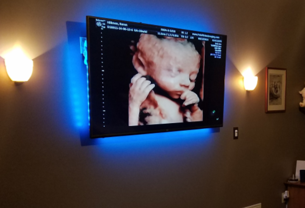 Fetal Vision Imaging | 1609 Woodbourne Rd #202b, Levittown, PA 19057 | Phone: (215) 948-8027