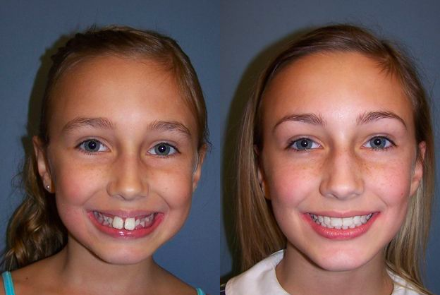 Kellyn Hodges Orthodontics | 2212 Street Rd 2nd Fl, Bensalem, PA 19020 | Phone: (215) 245-5100