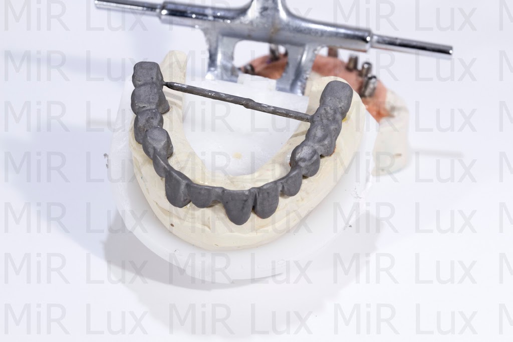 Mir Lux Dental Lab | 4 E Bristol Rd STE B, Feasterville-Trevose, PA 19053 | Phone: (215) 850-8680