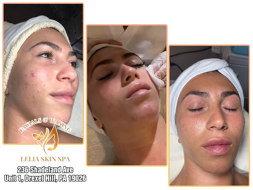 Lelia Skin Spa | 236 Shadeland Ave Unit 1, Drexel Hill, PA 19026 | Phone: (215) 200-9080