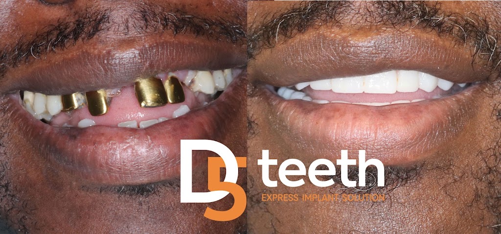 D5teeth - Philadelphia | 700 S Henderson Rd SUITE 306, King of Prussia, PA 19406 | Phone: (215) 253-5925