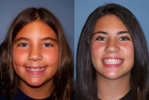 Kellyn Hodges Orthodontics | 2212 Street Rd 2nd Fl, Bensalem, PA 19020 | Phone: (215) 245-5100